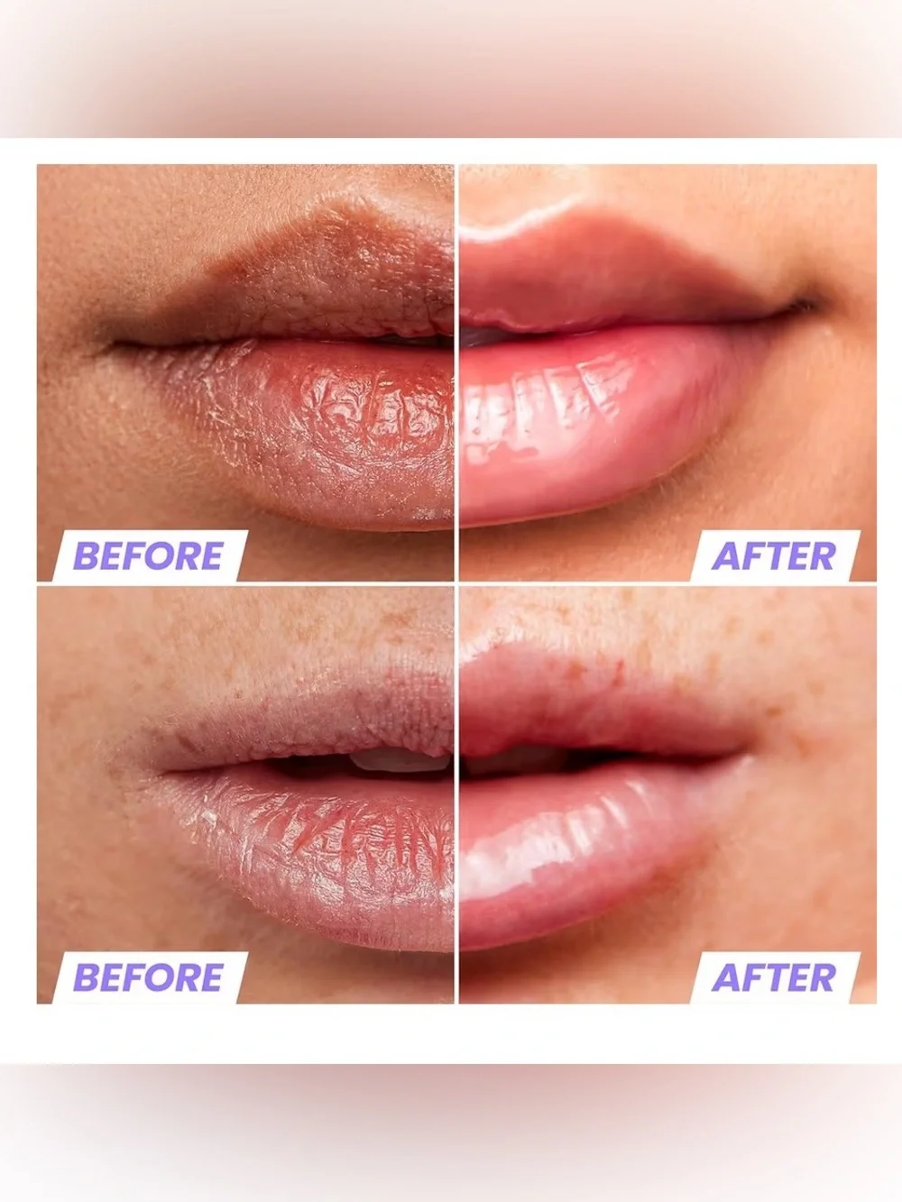 WONDERSKIN Lip Rehab Serum Oil in Clear. NIB 3.57 ml / 0.12 Oz